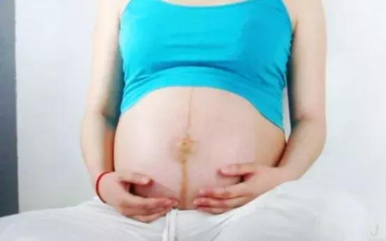 孕妇肚子上为什么会有一条黑线,孕妇肚子上长黑线是怎么回事