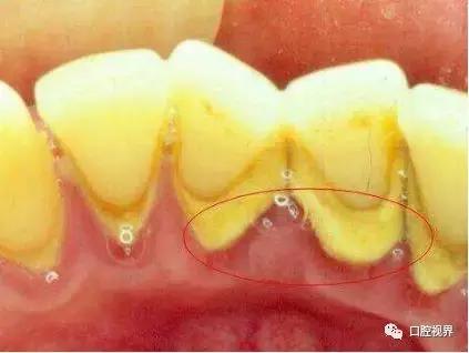 口腔科普咨询,口腔医院挂号预约流程
