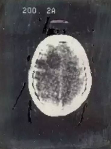 农场里走出CT鼻祖，美苏核危机诞生磁共振