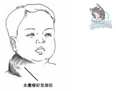 超声检查NT异常，该怎么办？