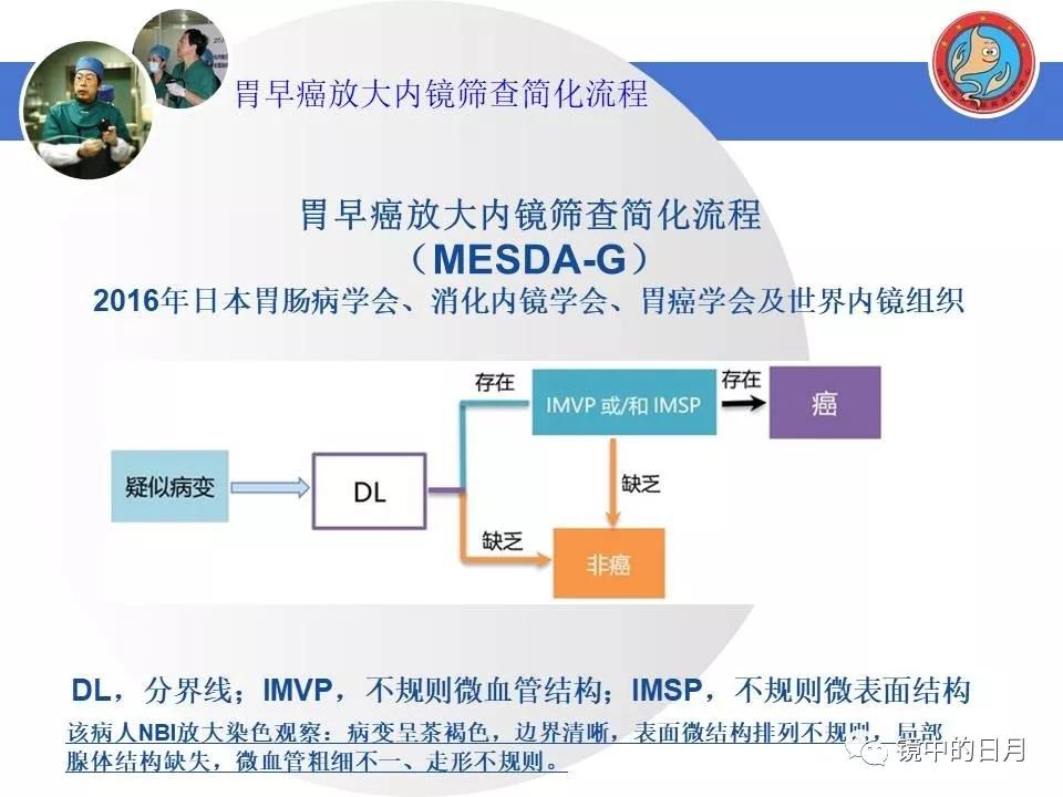 低分化胃癌早期时候做内镜手术吗,早期胃癌内镜手术后追加外科手术