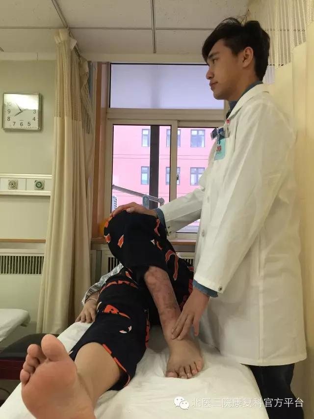 髋关节撞击综合征微创手术恢复,关节镜微创术半月板修复后康复