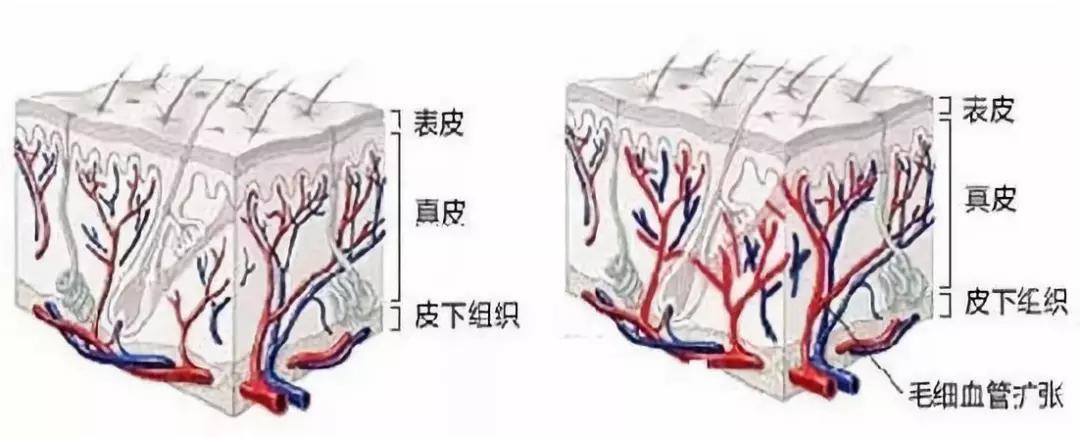 七种方法教你摆脱红血丝,红血丝的正确调理方法