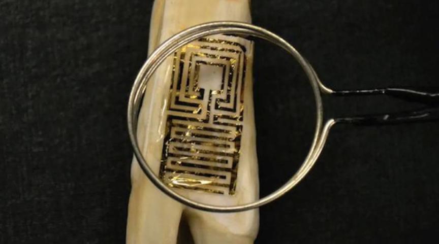 全球流行纹身,牙齿纹身图