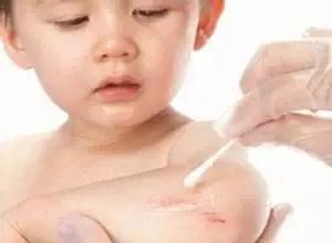 小孩手被烫伤起泡后破了怎么处理,小孩被烫伤起泡破了怎么处理