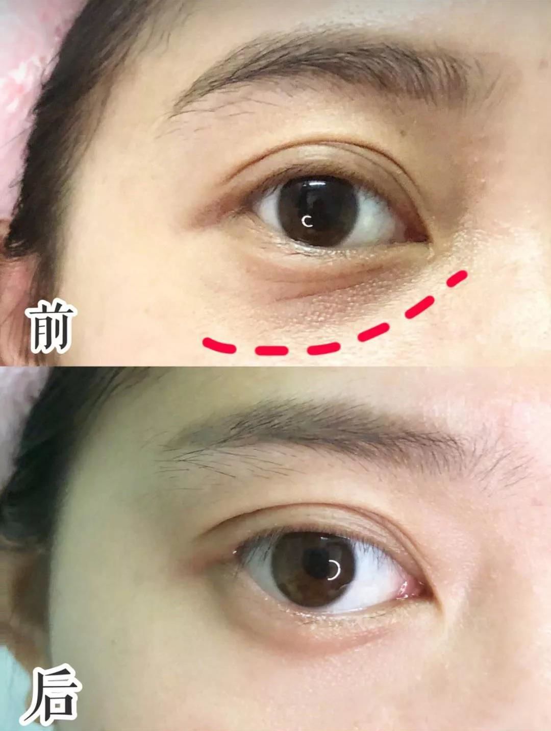 陈乔恩金箔面膜,陈乔恩皮肤真好