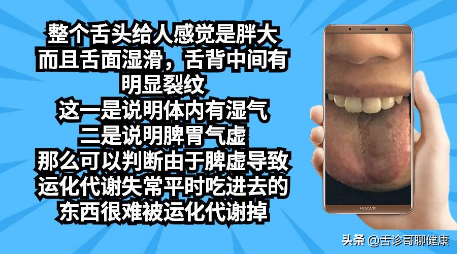 舌诊哥：遗精滑精、气短、虚汗、紧张、焦虑等舌象分析