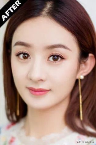 整形医生科普割双眼皮必看攻略,割双眼皮一定好看吗