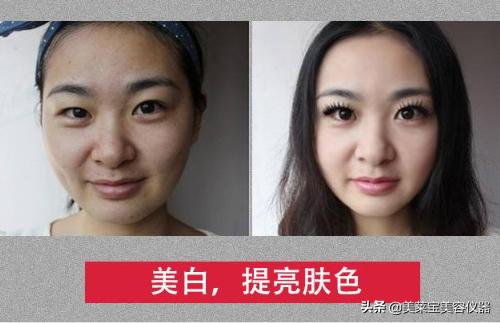 小气泡美容仪器清洗,美容小气泡有什么效果