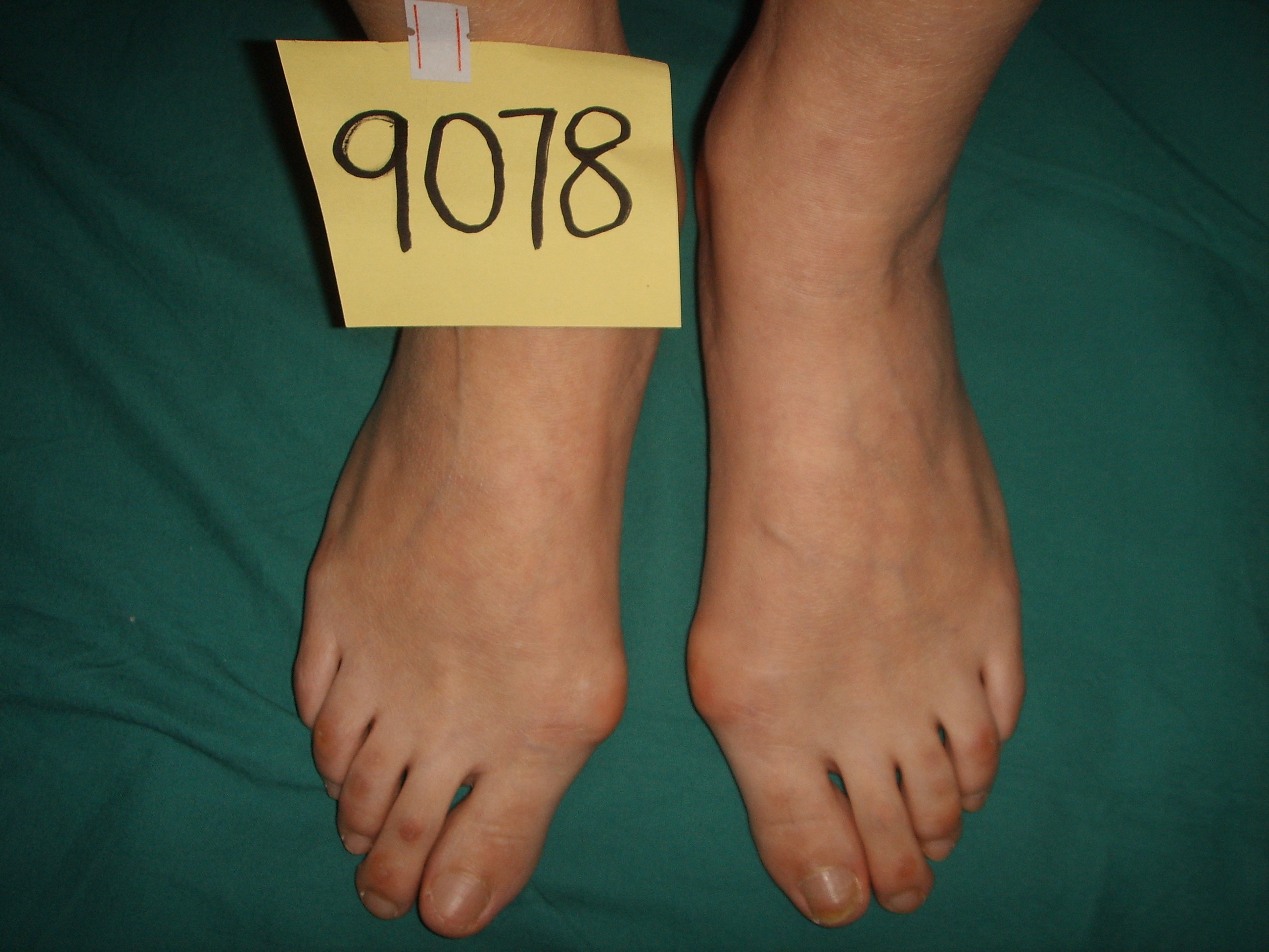 30岁的女人大脚骨,脚大的女生想穿小皮鞋