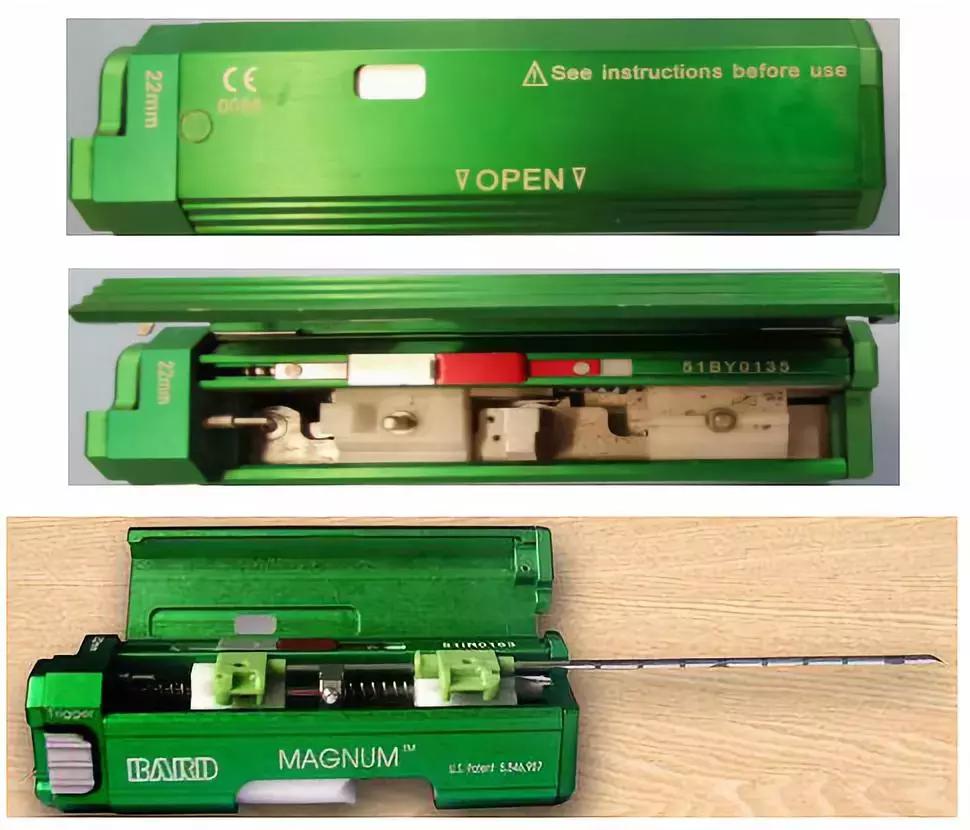 ct引导下穿刺活检诊断的分析,超声引导下穿刺活检什么样子的呢