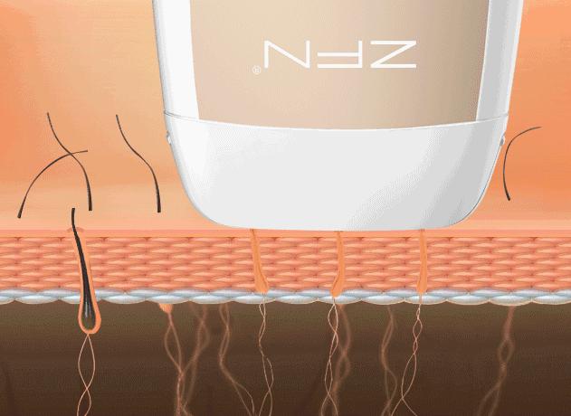 夏日脱毛攻略高效家用脱毛仪分享,脱毛必备好物脱毛仪