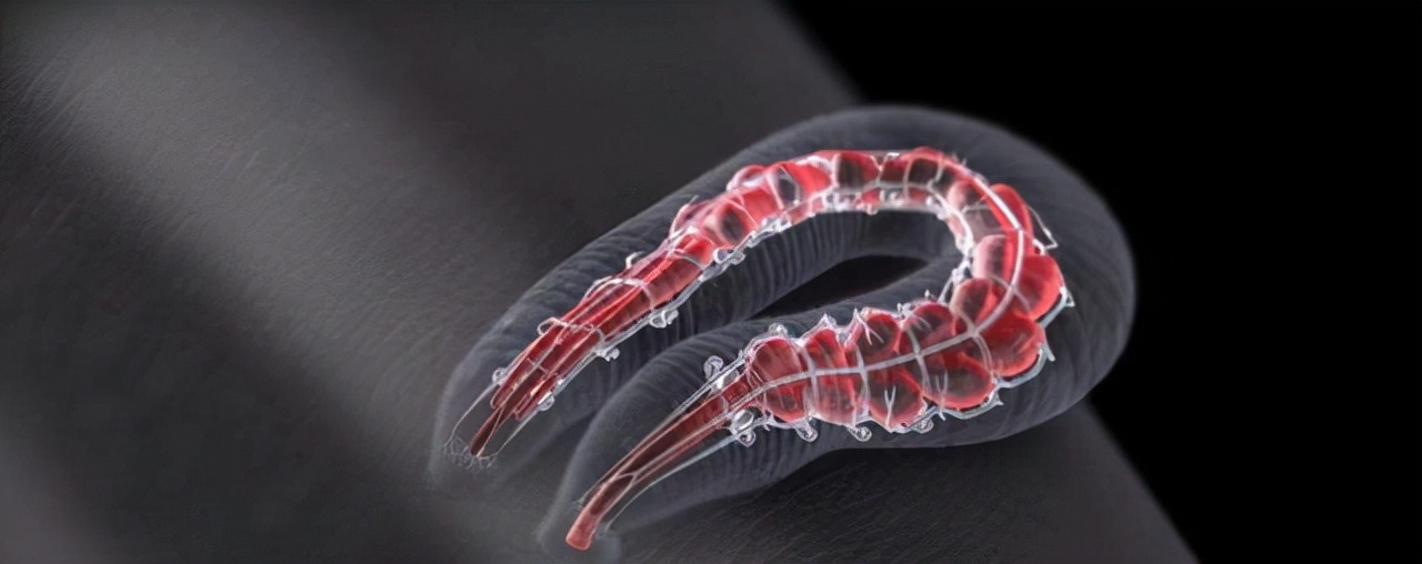 不小心把蚂蝗吞进肚子里会死吗,误吃蚂蟥在身体里能活吗