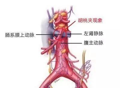 儿童血尿诊断与鉴别诊断,6岁儿童血尿是什么原因引起的