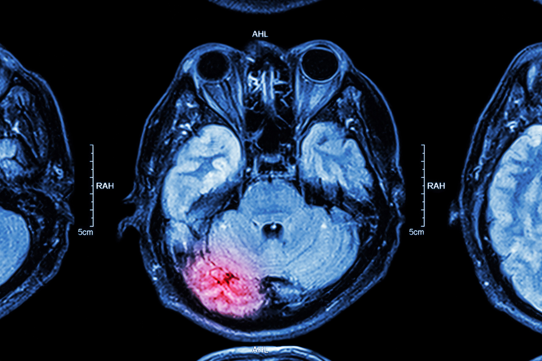 尿频，17种可能