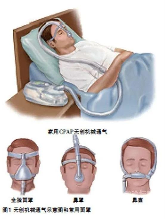 呼吸机利弊大揭秘,呼吸机的基本常识