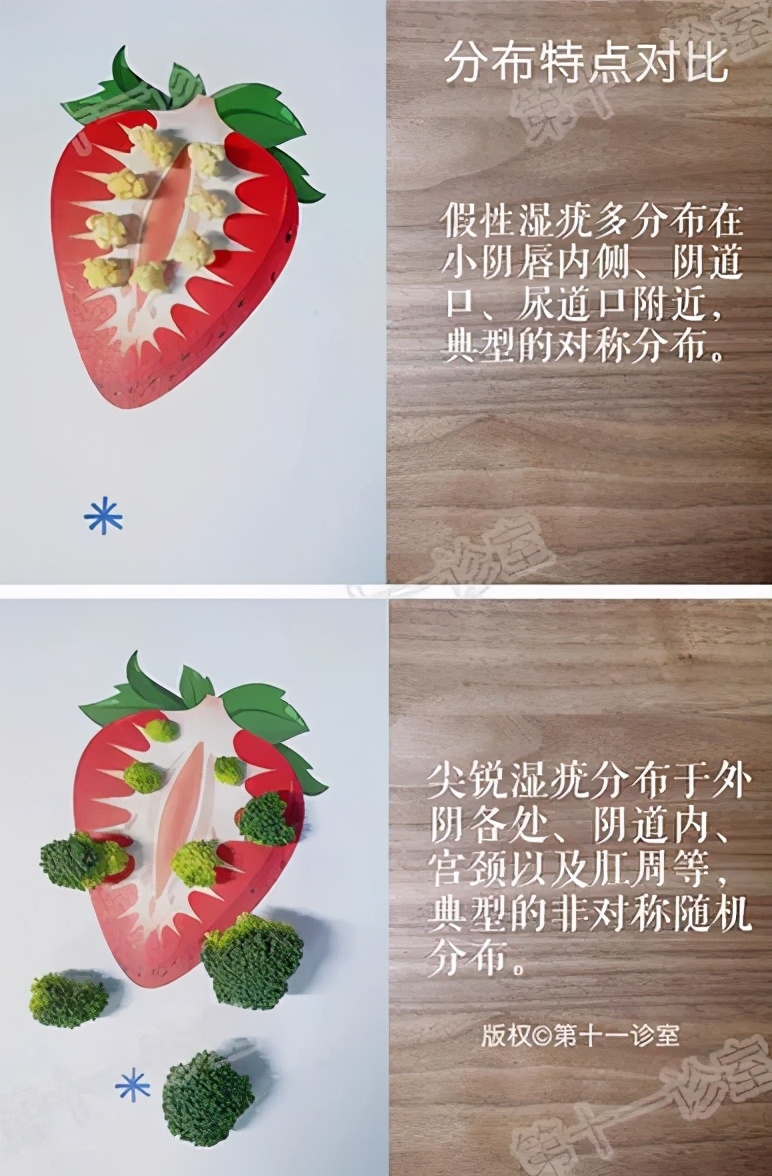 痛得合不拢腿、迈不开步,*处私**长的这东西到底是啥啊?