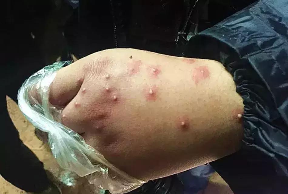 只因在草丛中被你咬一口，再也没能忘掉那感受