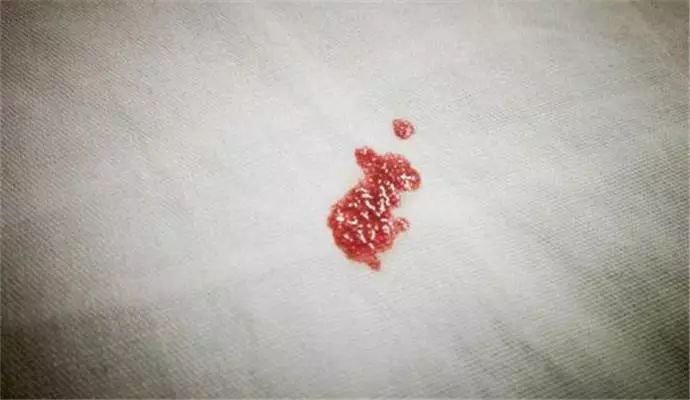 月经量少排卵不好吗,月经量少排卵的卵子质量好吗