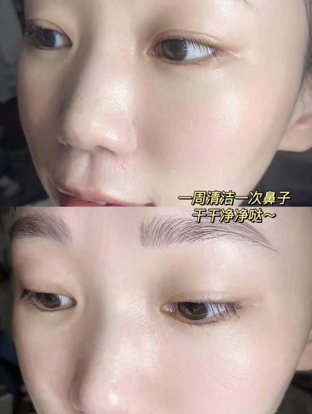 去黑头收缩毛孔的最好方法甲硝唑,男士去黑头收缩毛孔洗面奶