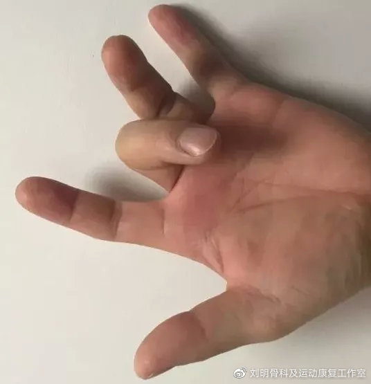 手指痛伸不开是什么原因引起的,手指伸不直一伸就疼有什么药