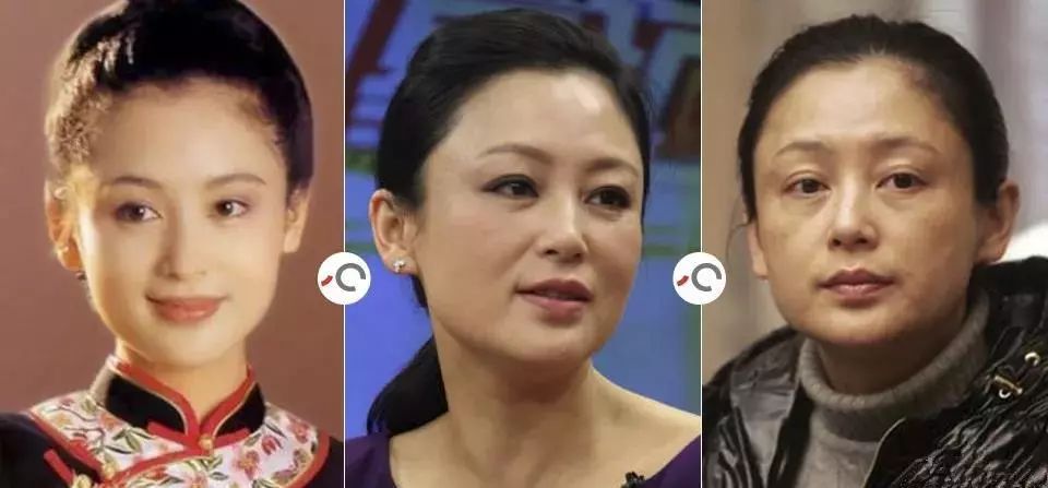 法令纹显老10岁三种方法帮助改善,最显老的法令纹怎么改善