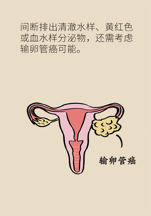 女性容易出现的一些高发病,很多女生都有的小问题