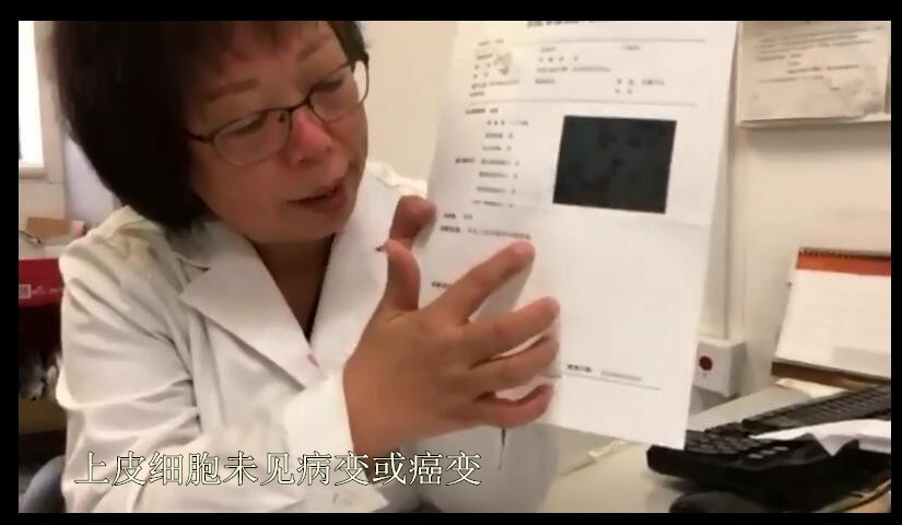 tct结果报告示中度炎症,tct提示中度炎症需要治疗么