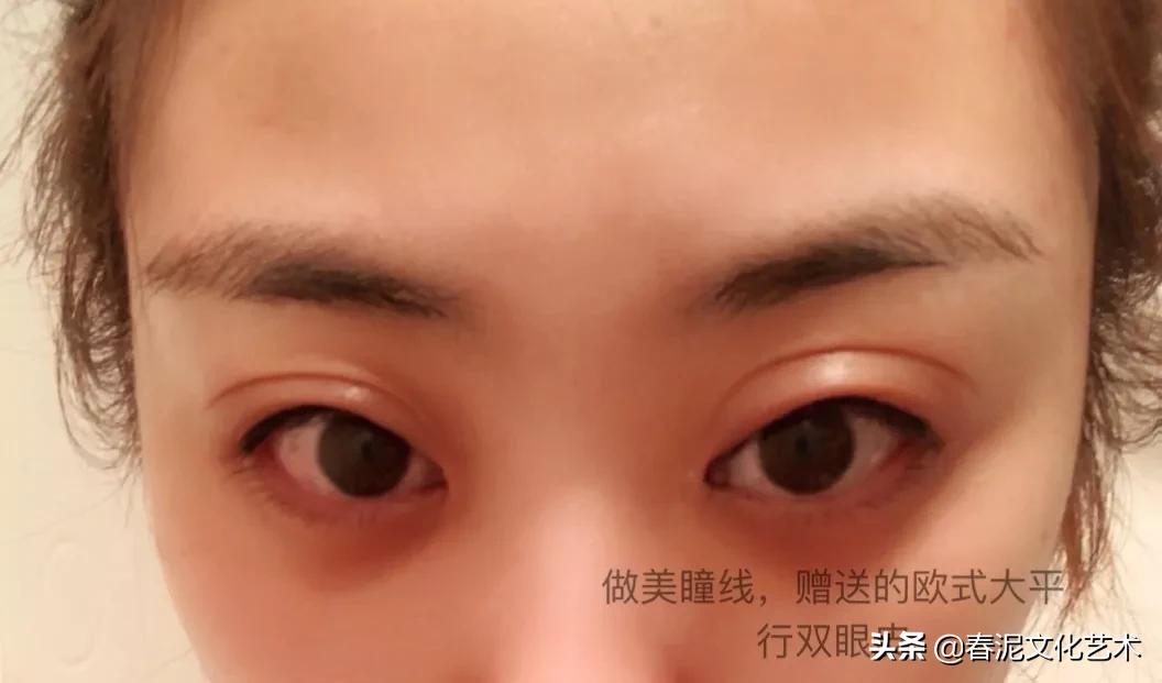 眼睛戴美瞳有血丝红肿怎么办,眼睛戴了美瞳红肿一碰就痛