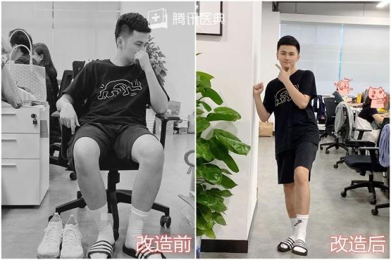 27岁男生脚臭,25岁帅哥脚臭怎么办