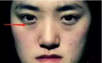 有眼袋太显老祛眼袋这里有妙招,有眼袋显老十岁一招教你消除