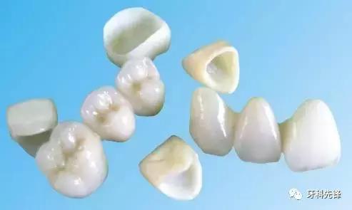 全瓷牙和烤瓷牙到底哪个好,烤瓷牙和全瓷牙优缺点及价格