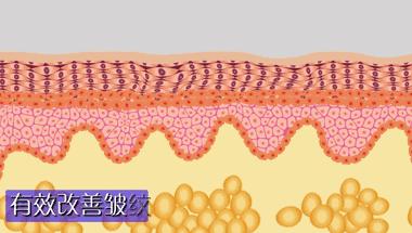 热拉提热玛吉fotona4d怎么选,热拉提抗衰
