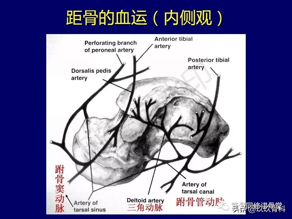 距骨骨折的治疗原则,距骨骨折如何调理