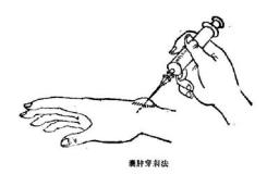 手腕出现小疙瘩越来越大,手腕突然长了一个小骨