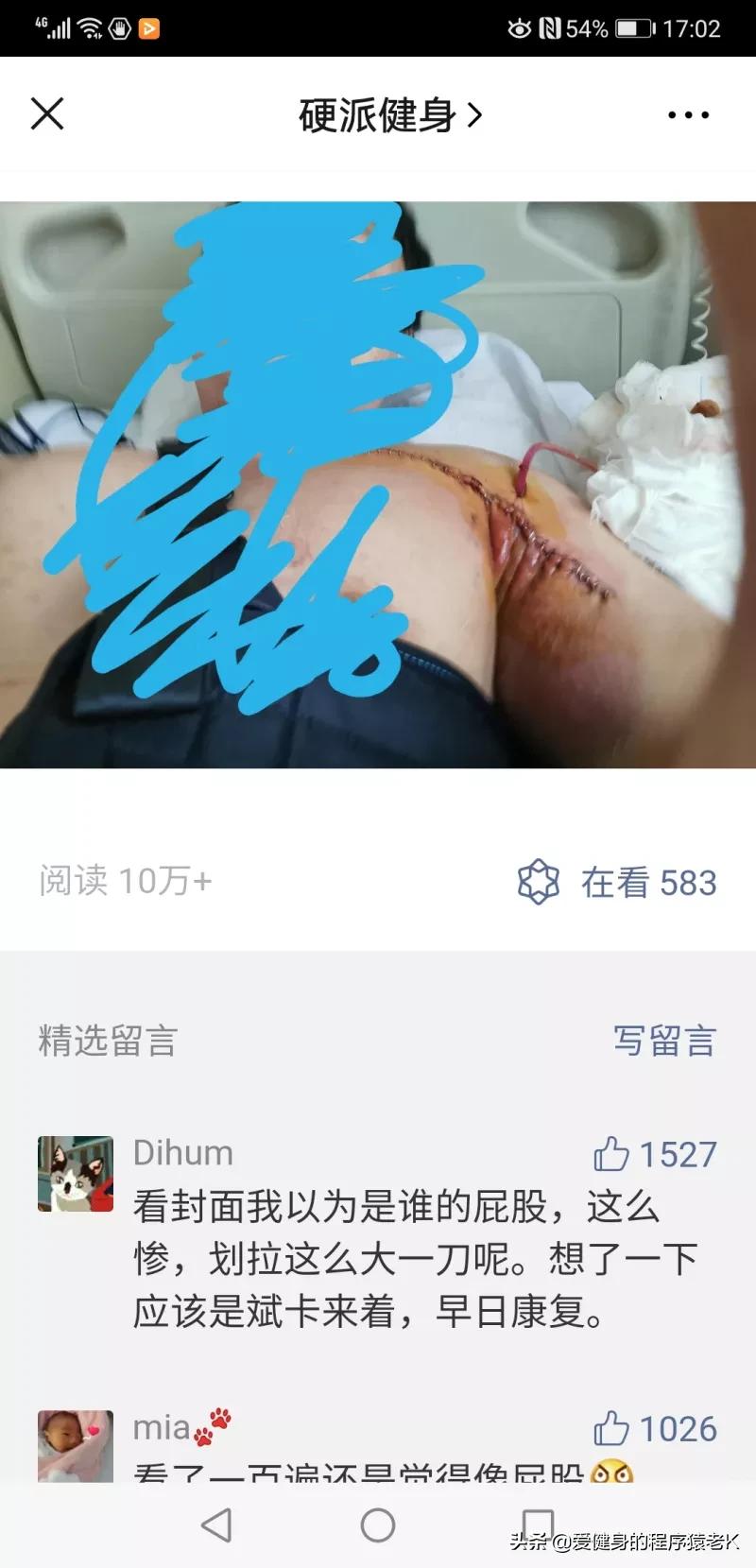 胸肌撕裂瞬间健身事故,国外著名健身大神胸肌撕裂