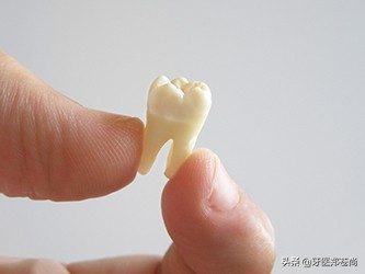 拔完阻生智齿后多久可以正常吃饭,拔完智齿忌口食物