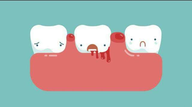 吃肉就塞牙怎么治疗,一吃东西都塞牙