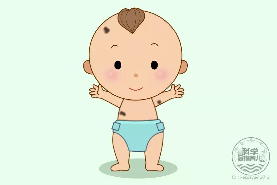 胎记很多痣密密麻麻,胎记是颗凸起的痣要去掉吗