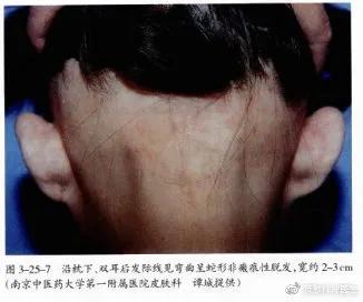 自我剖析问题原因和整改措施,自我诊断原因分析及改进措施