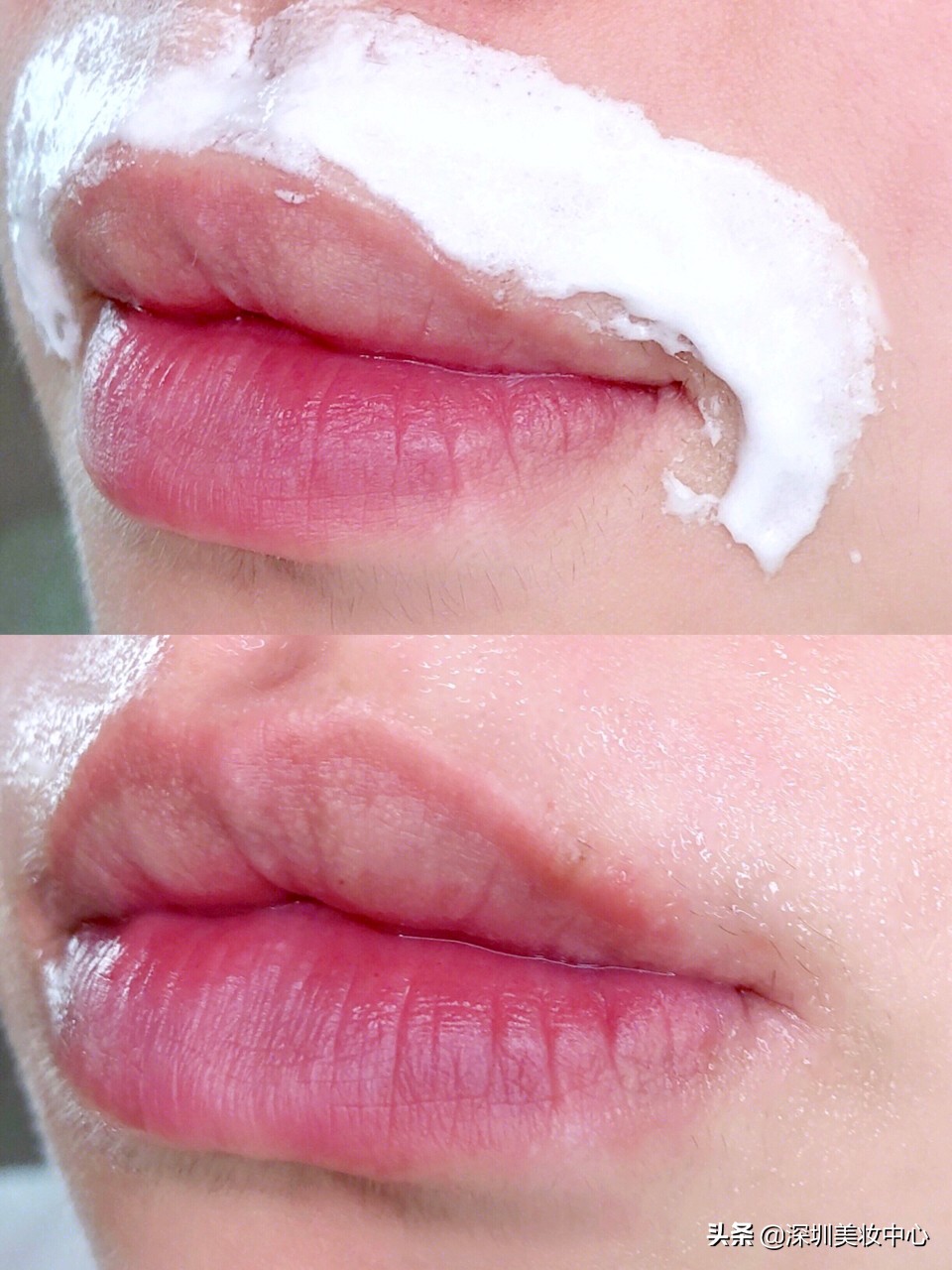女生有小胡子怎么办小妙招,怎样去除女人嘴唇胡须