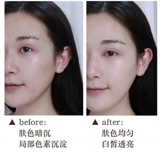 夏季护肤品不要乱用,夏天别乱用护肤品