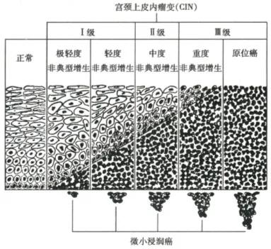 关于宫颈疾病的科普节目,宫颈筛查的注意事项科普视频