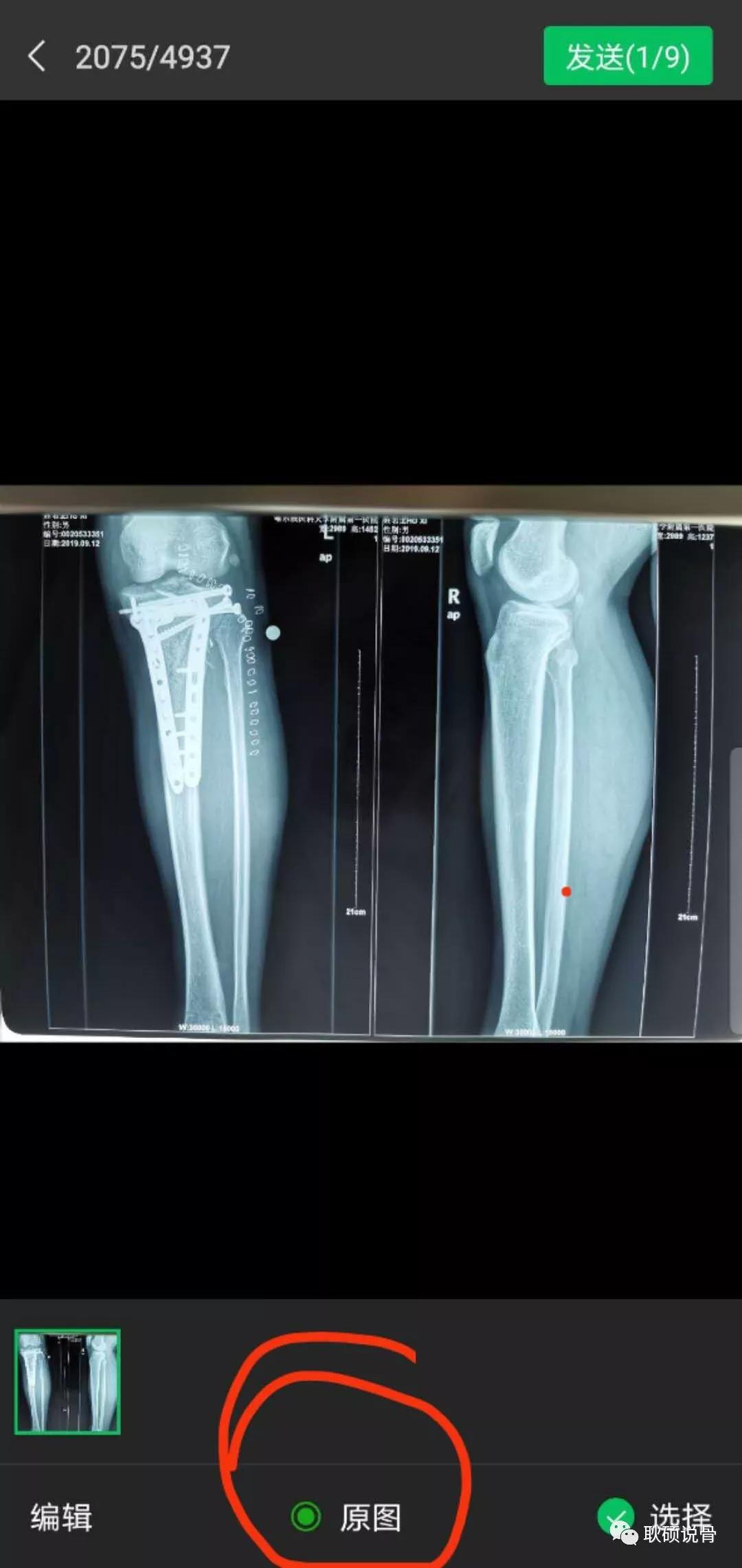 互联网医疗线上问诊,线上医生咨询app哪个好免费