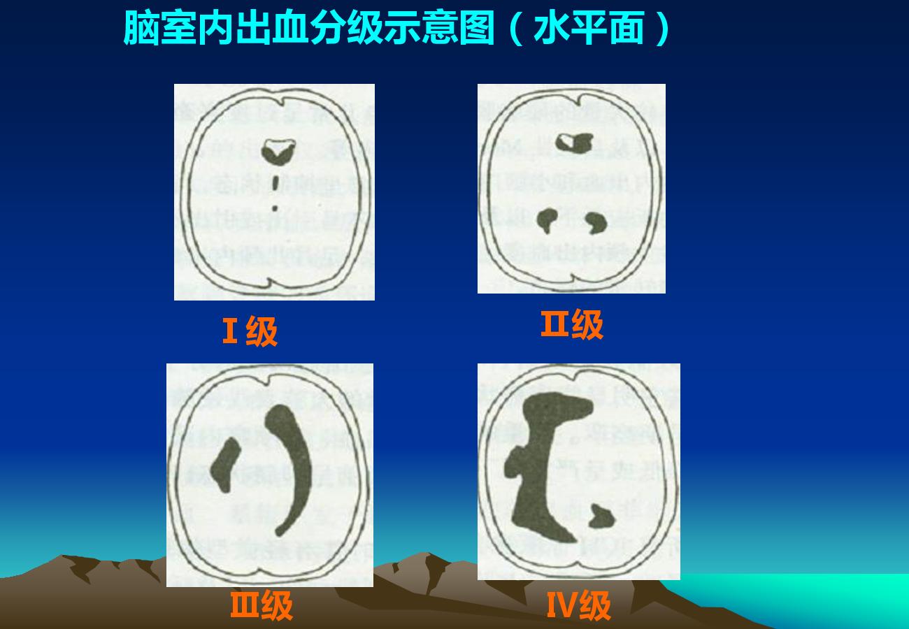 新生儿颅内出血长大后有后遗症吗,新生儿颅内一级出血会影响智力吗