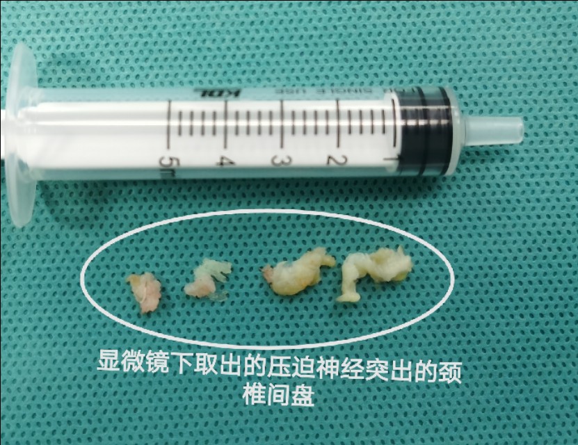 疫情期间颈椎病发作怎么办,疫情间躺久了头昏眼胀怎么治