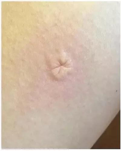 宝宝总爱招蚊子？如何驱蚊、止痒？真正有效的方法，只有这几种