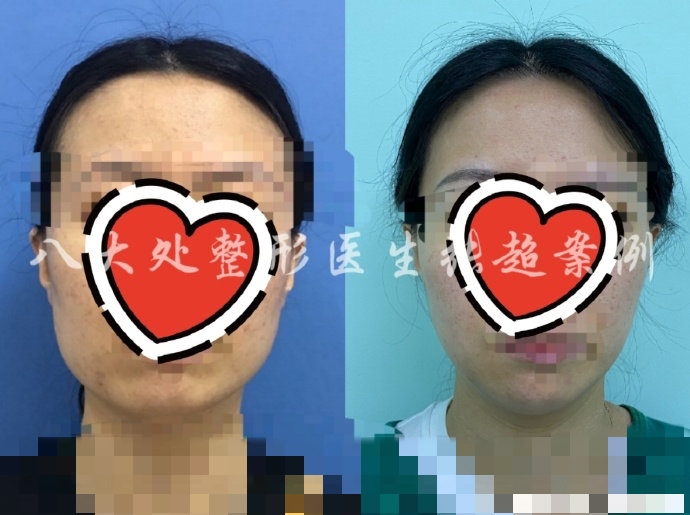 八大处张超抖音,八大处张超合集