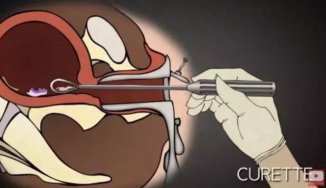 丁嘉丽明星的故事,丁嘉丽央视