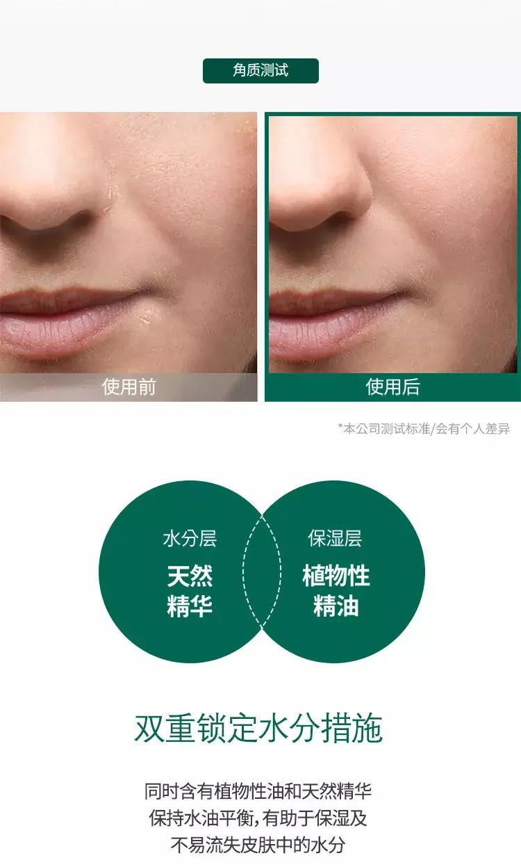 somebymi柚子精华可以祛痘印吗,茶树痘肌修复精华